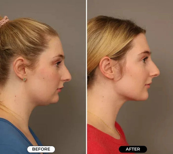 FlexiFace™ Therapy: Das ultimative 4-in-1-Massagegerät für Gesichtspflege und Entspannung