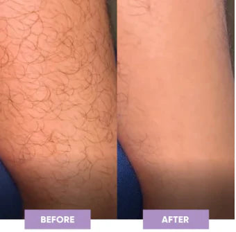 GlowShave™Für glatte und strahlende Haut.